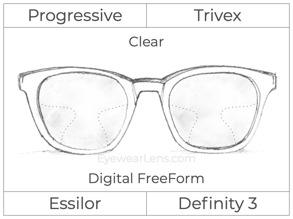 Progressive - Essilor - Definity 3 Plus - Digital FreeForm - Trivex - Clear